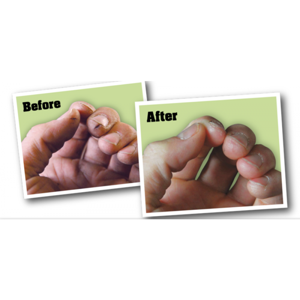 O'Keeffe's - Working Hands Crema Mani Estremamente Screpolate Confezione 96 Gr - Foto 2